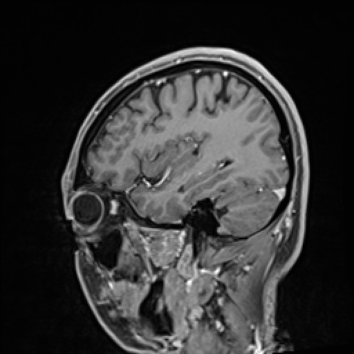 Click on the Serie image to view the images of VILLANUEVA, WILLIAM A.